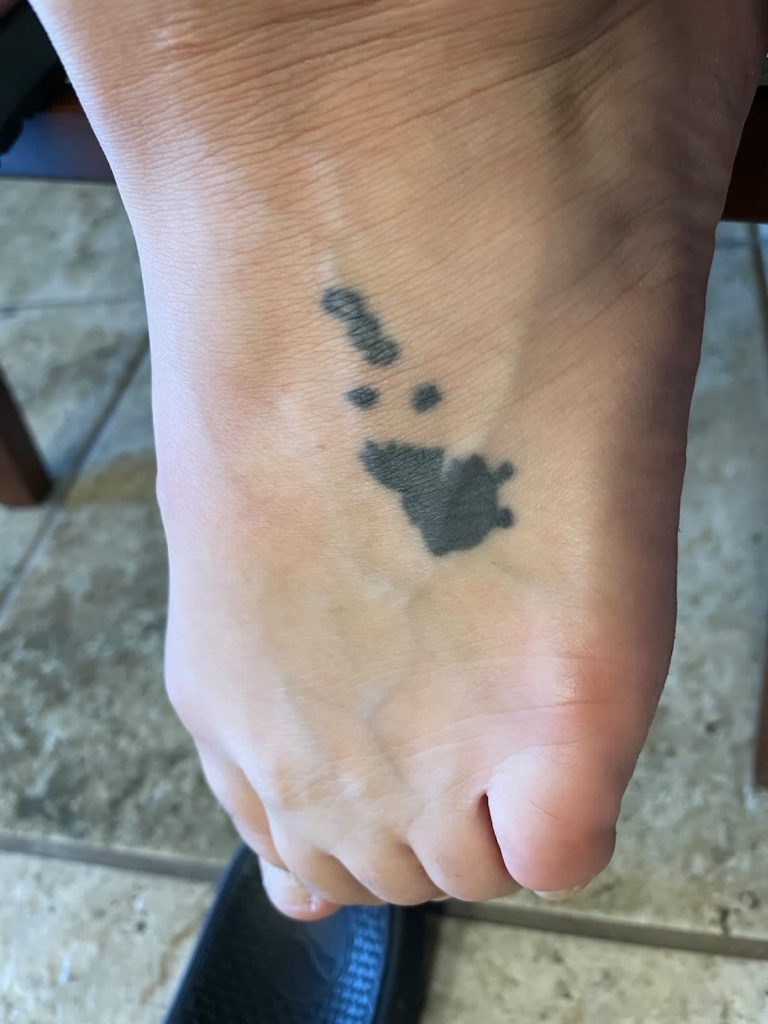 San Diego Magazine's user submitted regrettable tattoos featuring a foot with a scene from Alice in Wonderland which appears more like the Hawaiian islands