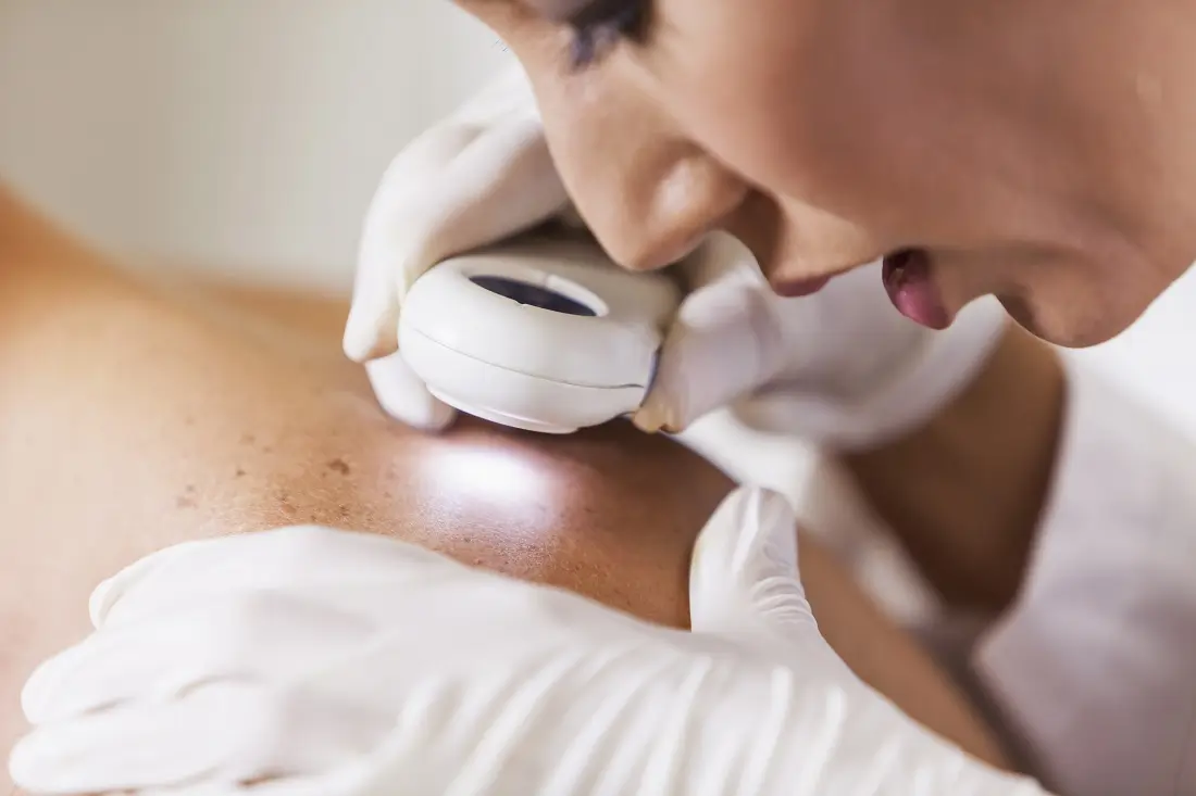 A dermatologists inspecting someone's skin for sun damage or skin cancer