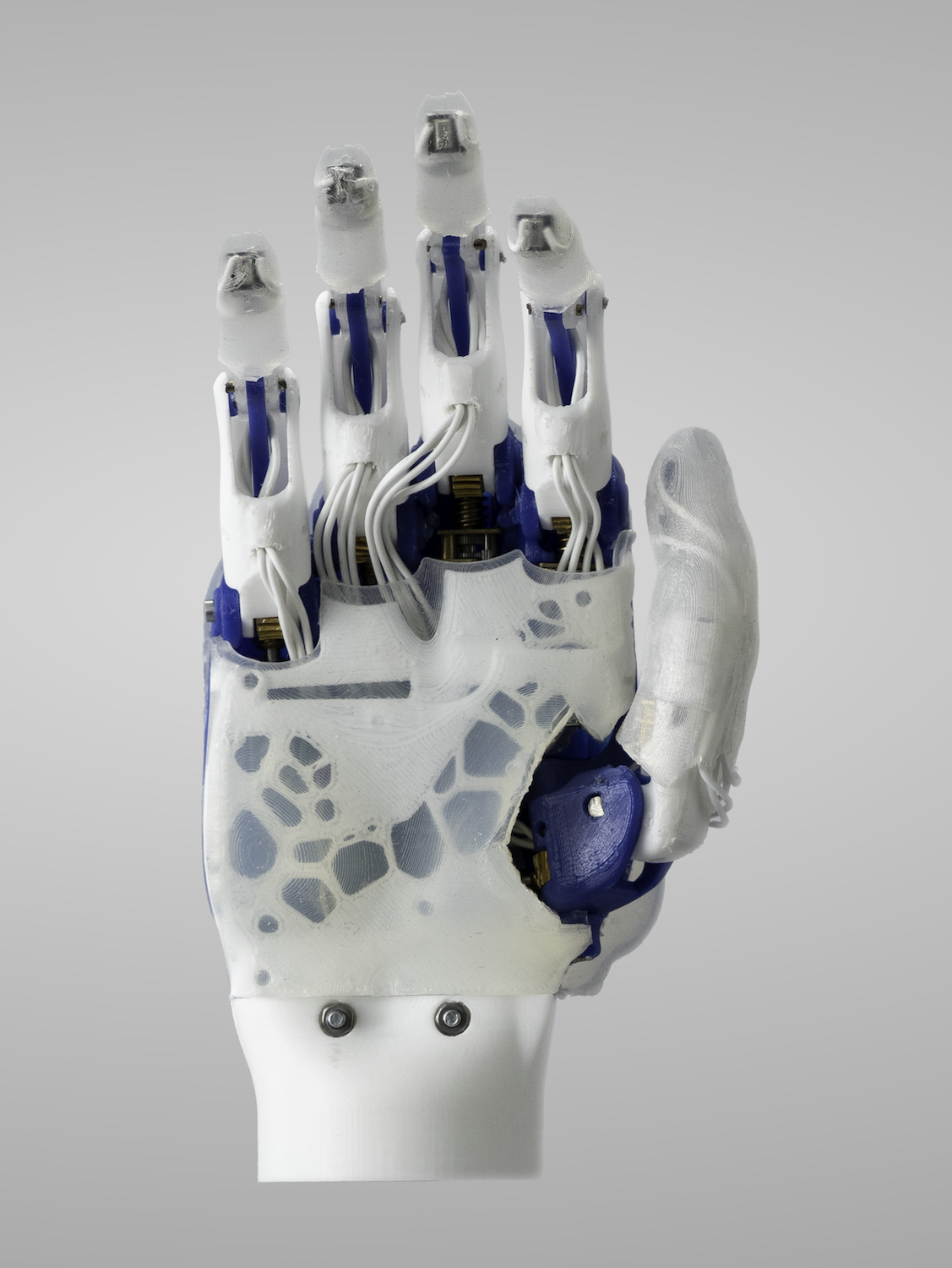 San Diego biomedical company Psyonic building the "Ability Hand" the most advanced bionic hand on the market
