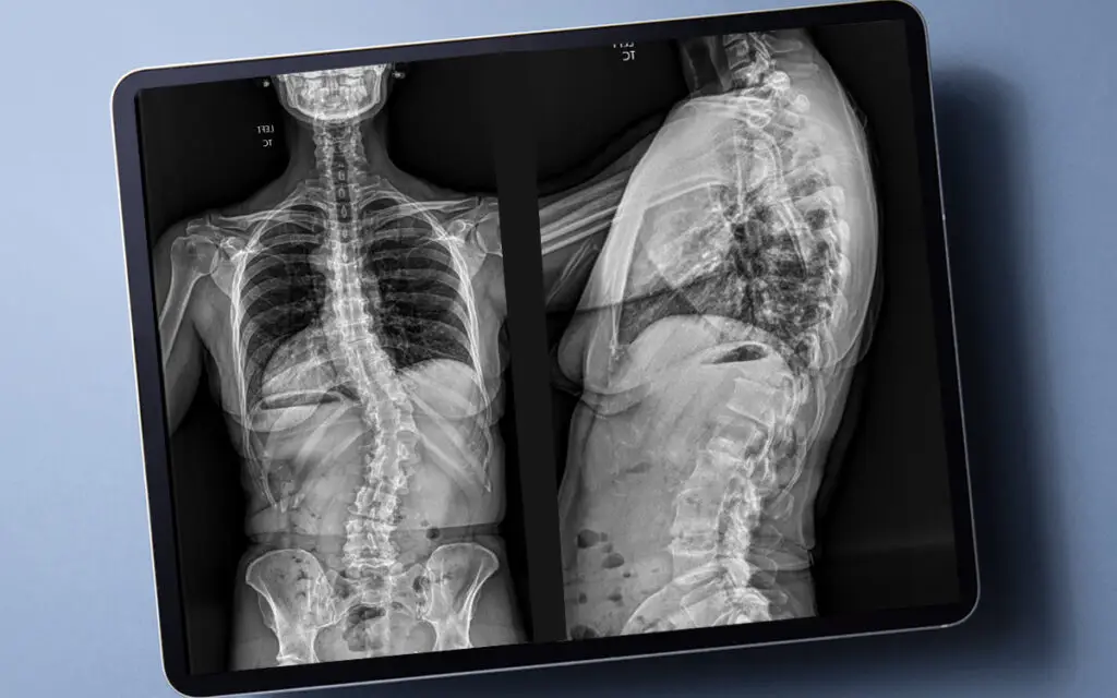 Innovative Spine Imaging Enhances Safety and Precision