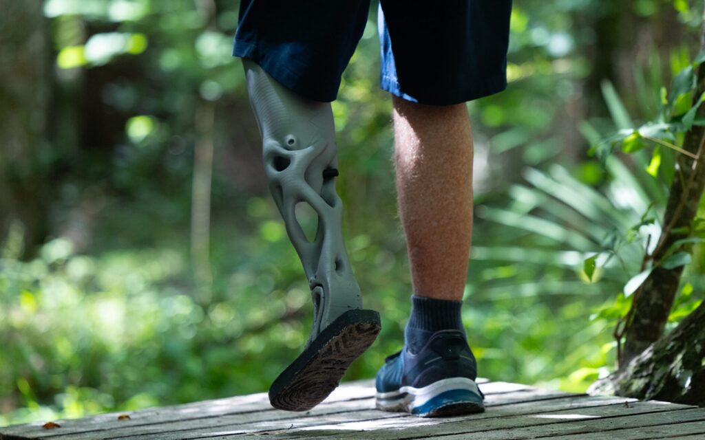 The 3D-Printed Prosthetic Disrupting a $10K+ Industry